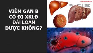 Bị viêm gan B có được đi XKLĐ Đài Loan hay không?